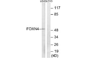 Western blot analysis of extracts from LOVO cells, using FOXN4 antibody. (FOXN4 antibody  (Internal Region))