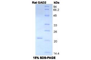 SDS-PAGE analysis of Rat GAD2 Protein. (GAD65 Protein)
