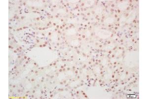 Formalin-fixed and paraffin embedded mouse kidney labeled with Rabbit Anti hospho-DDX5 (Tyr593) Polyclonal Antibody, Unconjugated (ABIN1387375) at 1:200 followed by conjugation to the secondary antibody and DAB staining (DDX5 antibody  (pTyr593))