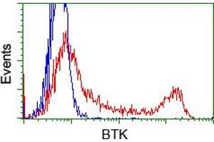 Image no. 1 for anti-Bruton Agammaglobulinemia tyrosine Kinase (BTK) antibody (ABIN1496975) (BTK antibody)
