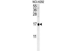 Western Blotting (WB) image for anti-Suppressor of IKBKE 1 (SIKE1) antibody (ABIN3002324)