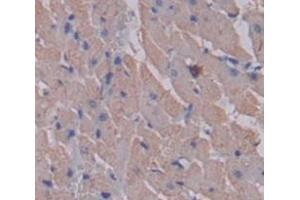 Used in DAB staining on fromalin fixed paraffin- embedded Kidney tissue (MYLK2 antibody  (AA 327-536))