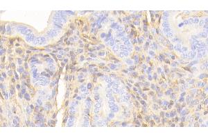 Immunohistochemistry (IHC) image for anti-Apolipoprotein A-I (APOA1) (AA 25-264) antibody (ABIN7429145)