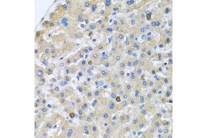 Immunohistochemistry of paraffin-embedded human liver using APOA5 antibody at dilution of 1:100 (40x lens).