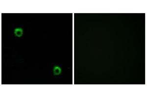Immunofluorescence analysis of MCF-7 cells, using FZD2 antibody. (FZD2 antibody  (Internal Region))