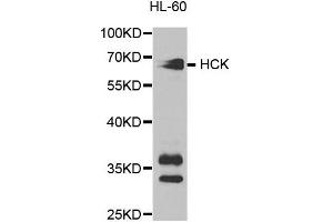Western blot analysis of extracts of HL-60 cell lines, using HCK antibody. (HCK antibody)