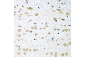 Immunohistochemistry of paraffin-embedded mouse brain using CCND2 antibody at dilution of 1:100 (40x lens). (Cyclin D2 antibody)