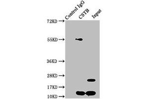 Immunoprecipitating CSTB in HepG2 whole cell lysate Lane 1: Rabbit control IgG instead of ABIN7148987 in HepG2 whole cell lysate. (CSTB antibody  (AA 1-98))