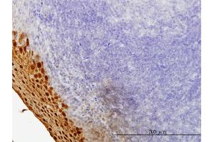 Immunoperoxidase of monoclonal antibody to SPRR3 on formalin-fixed paraffin-embedded human tonsil. (SPRR3 antibody  (AA 1-161))