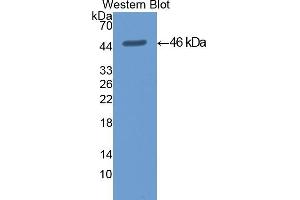 Detection of Recombinant KRT19, Mouse using Polyclonal Antibody to Cytokeratin 19 (CK19) (Cytokeratin 19 antibody  (AA 1-403))