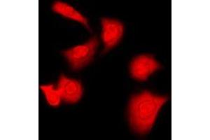 Immunofluorescent analysis of PKA C alpha/beta staining in Raw264. (PKA/C alpha/beta (N-Term) antibody)