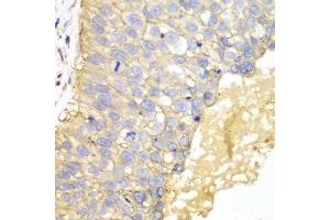 Immunohistochemistry (IHC) image for anti-Epithelial Cell Adhesion Molecule (EPCAM) (AA 40-260) antibody (ABIN3021638)