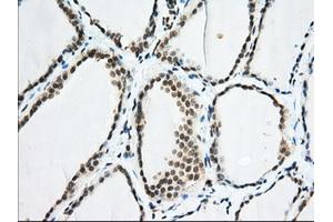 Immunohistochemical staining of paraffin-embedded Human colon tissue using anti-EIF2S1 mouse monoclonal antibody. (EIF2S1 antibody)