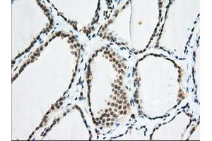 Immunohistochemical staining of paraffin-embedded Human colon tissue using anti-EIF2S1 mouse monoclonal antibody. (EIF2S1 antibody)