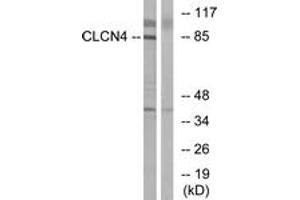 Western blot analysis of extracts from MCF-7 cells, using CLCN4 Antibody.