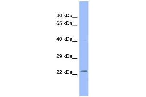 WB Suggested Anti-AK3L1 Antibody Titration:  0. (AK4 antibody  (N-Term))