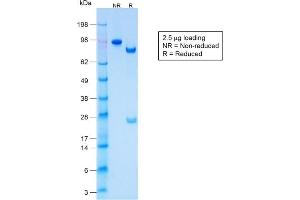 SDS-PAGE Analysis Purified CK LMW Rabbit Recombinant Monoclonal Antibody (KRTL/1577R). (Recombinant Keratin 77 antibody)