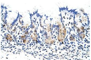 TROVE2 antibody was used for immunohistochemistry at a concentration of 4-8 ug/ml to stain Epithelial cells of fundic gland (arrows) in Human Stomach.