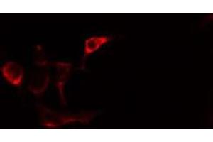 ABIN6275486 staining Hela cells by IF/ICC. (ALDH1A2 antibody  (C-Term))