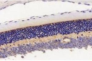 Immunohistochemistry analysis of paraffin-embedded mouse eyeball using,KCNV2 (ABIN7075150) at dilution of 1: 2800 (KCNV2 antibody)