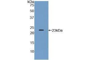 Western blot analysis of recombinant Human PTPRN. (PTPRN antibody  (AA 368-575))