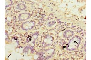 Immunohistochemistry of paraffin-embedded human small intestine tissue using ABIN7171670 at dilution of 1:100 (TCTEX1D2 antibody  (AA 1-142))