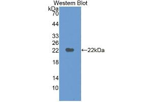 Western blot analysis of the recombinant protein. (M6PR antibody  (AA 27-185))