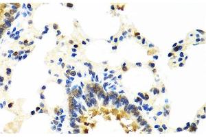 Immunohistochemistry of paraffin-embedded Rat lung using CRTAP Polyclonal Antibody at dilution of 1:100 (40x lens). (CRTAP antibody)