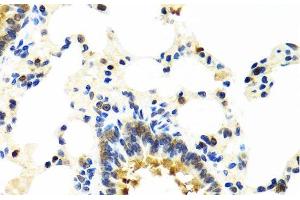 Immunohistochemistry of paraffin-embedded Rat lung using CRTAP Polyclonal Antibody at dilution of 1:100 (40x lens).