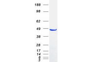 Western Blotting (WB) image for Sorting Nexin 5 (SNX5) (Transcript Variant 2) protein (Myc-DYKDDDDK Tag) (ABIN2732407)