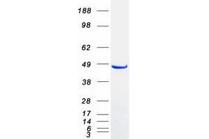 Validation with Western Blot (SNX5 Protein (Transcript Variant 2) (Myc-DYKDDDDK Tag))