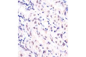 Paraformaldehyde-fixed, paraffin embedded human stomach tissue, Antigen retrieval by boiling in sodium citrate buffer (pH6. (APEX1 antibody)