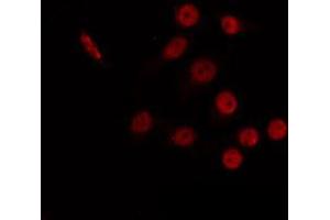 ABIN6266765 staining 293 by IF/ICC. (CBX6 antibody  (N-Term))