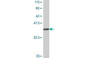 Western Blot detection against Immunogen (37 KDa) . (PARN antibody  (AA 501-599))