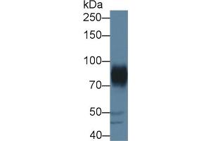 Western Blot; Sample: Porcine Cerebrum lysate; Primary Ab: 1µg/ml Rabbit Anti-Human ADAM22 Antibody Second Ab: 0.