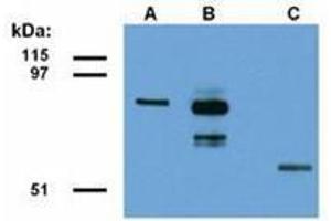Western Blotting (WB) image for anti-Family with Sequence Similarity 175, Member A (FAM175A) (AA 1-313), (N-Term) antibody (ABIN487439)