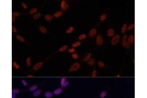 Immunofluorescence analysis of NIH-3T3 cells using Phospho-Histone H3(T11) Polyclonal Antibody at dilution of 1:100.