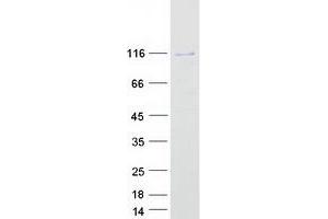 Validation with Western Blot (Six5 Protein (Myc-DYKDDDDK Tag))