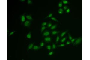 Immunofluorescence analysis of U2OS cells using SSRP1 antibody (ABIN6129537, ABIN6148493, ABIN6148495 and ABIN6222048). (SSRP1 antibody  (AA 1-300))