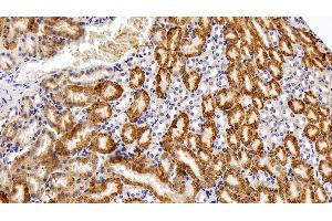 Detection of CAT in Mouse Kidney Tissue using Polyclonal Antibody to Catalase (CAT) (Catalase antibody  (AA 401-523))