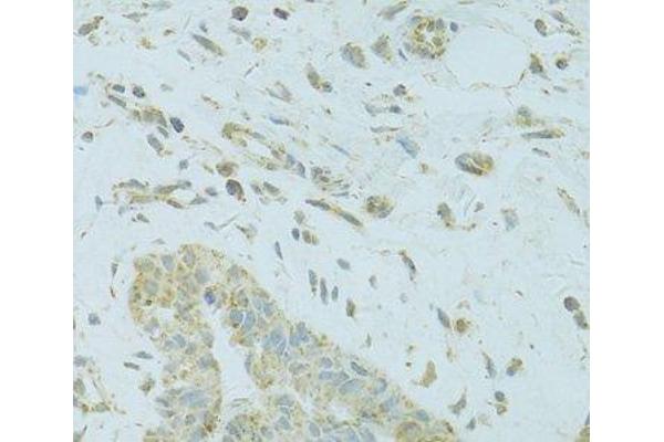 Mtfp1 antibody