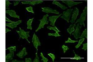 Immunofluorescence of monoclonal antibody to HLA-DMB on HeLa cell.