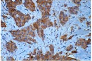 Immunohistochemistry (IHC) image for anti-Tubulin, beta 3 (TUBB3) antibody (ABIN1109374) (TUBB3 antibody)