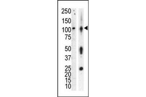 Western blot analysis of anti-PKCnu Pab in lysate of HL60 cells stimulated with PMA (lane A) and mouse brain tissue lysate (lane B). (PRKD3 antibody  (Middle Region))