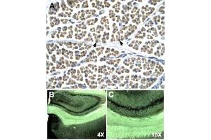 Immunohistochemical staining (Formalin-fixed paraffin-embedded sections) of human muscle (A) and rat brain (B, C) with GABRD polyclonal antibody . (GABRD antibody  (N-Term))