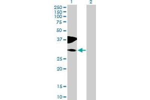 Western Blot analysis of C10orf81 expression in transfected 293T cell line by C10orf81 MaxPab polyclonal antibody. (C10orf81 antibody  (AA 1-282))
