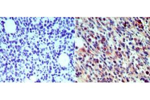 Langerin Immunohistochemistry. (CD207 antibody)