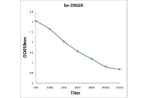 ELISA image for anti-Deiodinase, Iodothyronine, Type III (DIO3) (AA 51-150) antibody (ABIN750883)