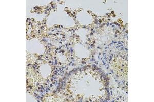 Immunohistochemistry of paraffin-embedded rat lung using PLK4 antibody (ABIN6003595) at dilution of 1/100 (40x lens). (PLK4 antibody)