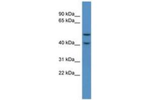 Image no. 1 for anti-Fukutin Related Protein (FKRP) (C-Term) antibody (ABIN6746249) (FKRP antibody  (C-Term))